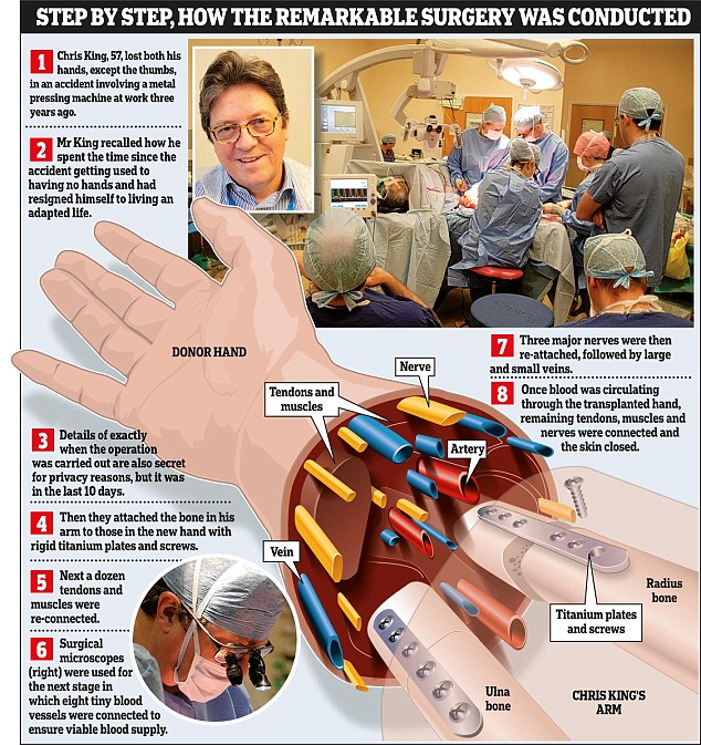 Hand transplant surgery .. step by step guide ..  recipient Mark